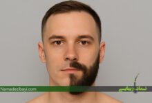 مشاوره پزشک و بیمار مرد درباره کاشت ریش در کلینیک زیبایی